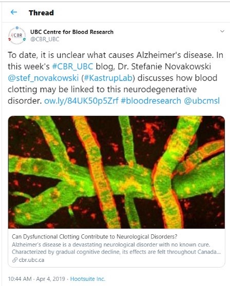 I tweeted, in lay terms, about one of our lab's new publication on Alzheimer's Research